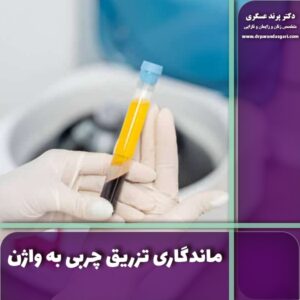 ماندگاری تزریق چربی به واژن