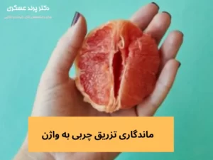 ماندگاری تزریق چربی به واژن