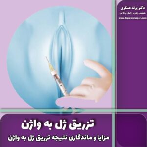 تزریق ژل به واژن