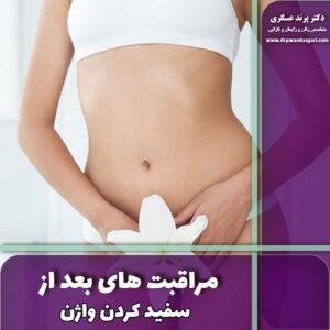 مراقبت های بعد از سفید کردن واژن