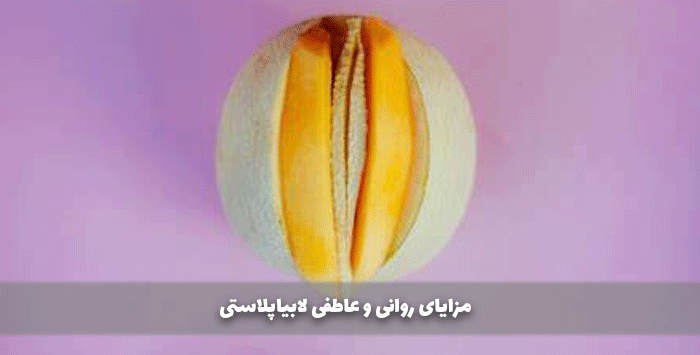 مزایای روانی و عاطفی لابیاپلاستی