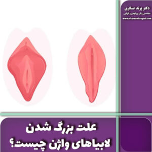 علت بزرگ شدن لابیاهای واژن