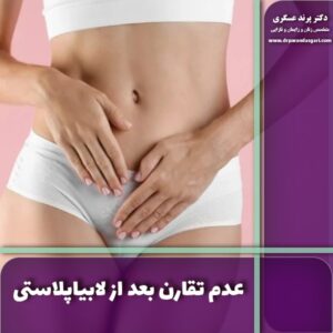 عدم تقارن بعد از لابیاپلاستی