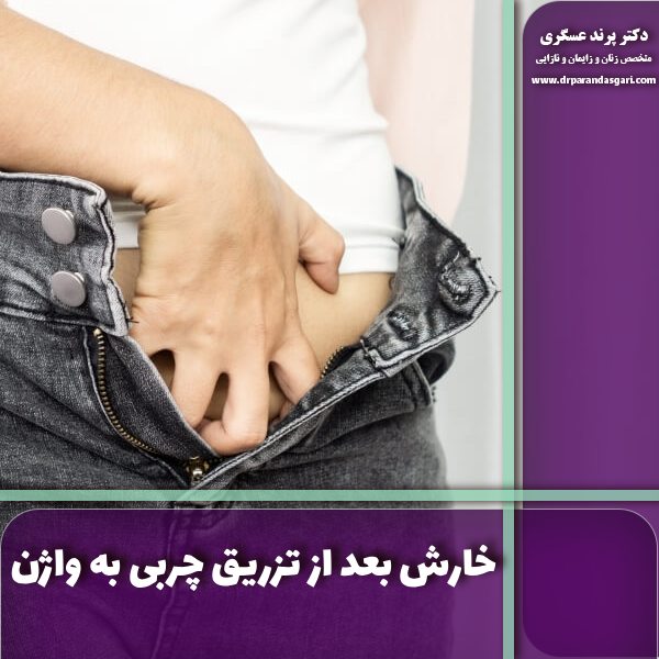 خارش بعد از تزریق چربی به واژن
