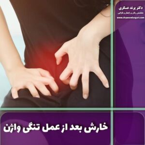 خارش بعد از عمل تنگی واژن