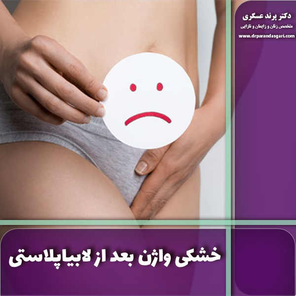 خشکی واژن بعد از لابیاپلاستی