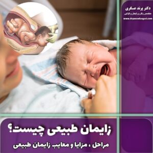 زایمان طبیعی