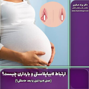 ارتباط لابیاپلاستی و بارداری چیست؟ (عمل لابیا قبل یا بعد حاملگی؟)