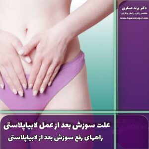 علت سوزش بعد از عمل لابیاپلاستی + راه های رفع سوزش بعد از لابیاپلاستی