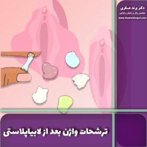 ترشحات واژن بعد از لابیاپلاستی