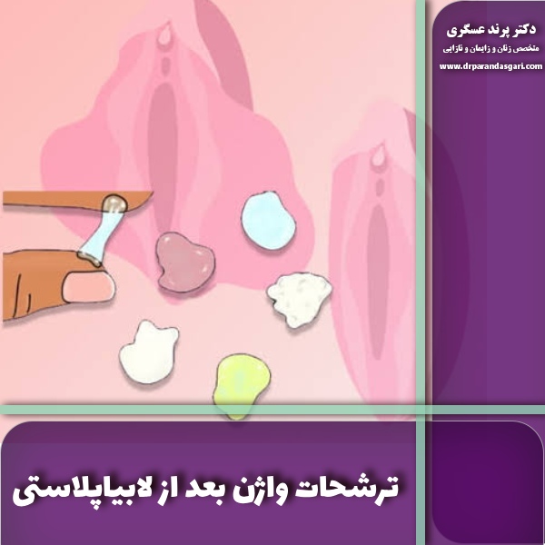ترشحات واژن بعد از لابیاپلاستی